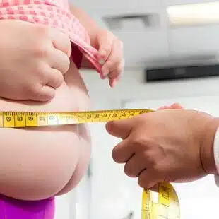 Obesidade infantil: como identificar sobrepeso e realizar adaptações