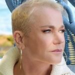 Xuxa revela ter alopecia e impulsiona debate sobre queda de cabelo feminina